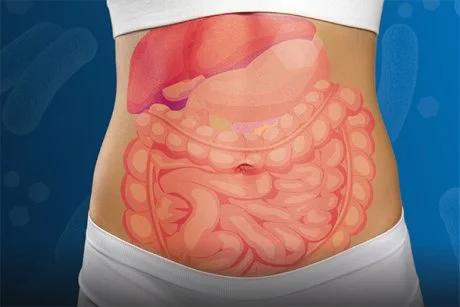 Bloating and Distension: Myths, Misconceptions, and the Microbiome Bloating and Distension: Myths, Misconceptions, and the Microbiome