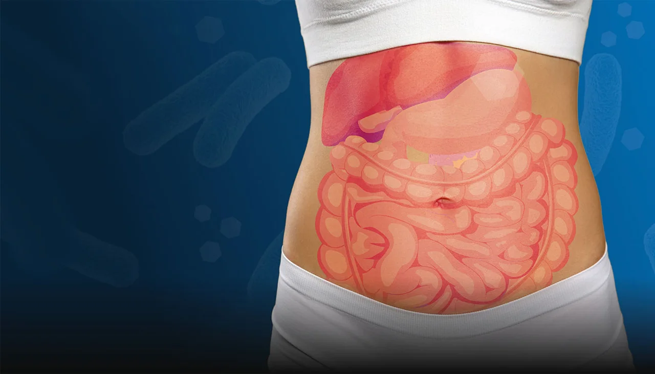 Bloating and Distension: Myths, Misconceptions, and the Microbiome Bloating and Distension: Myths, Misconceptions, and the Microbiome