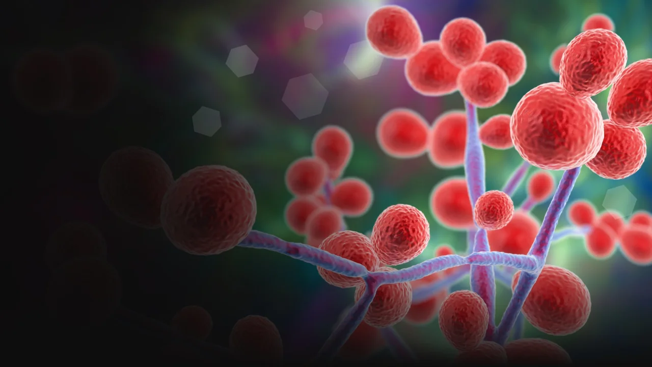 Candida Overgrowth Case Review With GI-MAP Candida Overgrowth Case Review With GI-MAP
