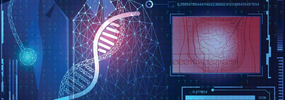 Common Gene Variant Predisposes to Irritable Bowel Syndrome Common Gene Variant Predisposes to Irritable Bowel Syndrome