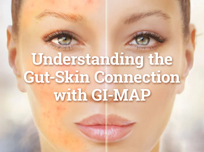 Understanding the Gut-Skin Connection with GI-MAP Understanding the Gut-Skin Connection with GI-MAP