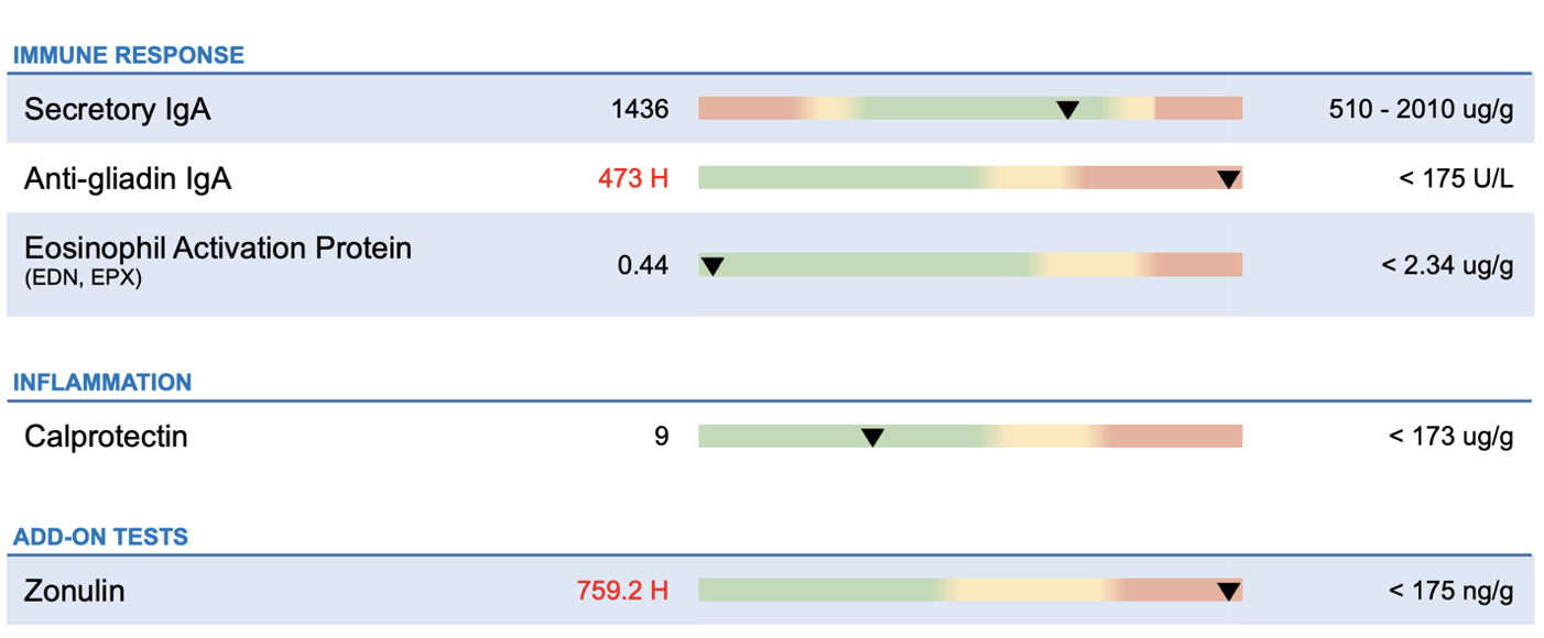 Immune Response - Inflammation - Zonulin